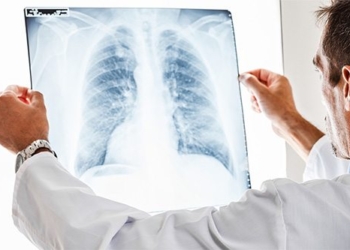 Metastasen bei Krebs: Ursachen, Symptome und Behandlung