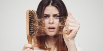 Hair loss: Causes, prevention methods and treatment