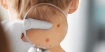 Что такое дерматология? Кожные заболевания и лечение