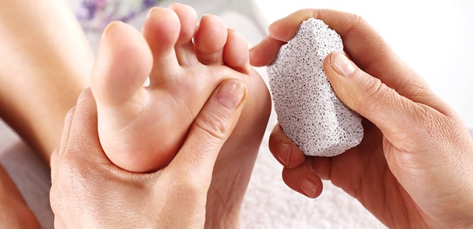 You are currently viewing Corns and foot calluses: Symptoms, treatment and home remedies