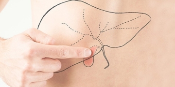 Las enfermedades de la vesícula biliar. Síntomas y el tratamiento