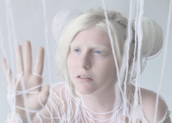 Was ist albino? Ursachen, Symptome und Behandlung von Albinismus