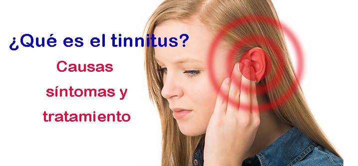 En este momento estás viendo ¿Qué es el tinnitus? Causas, síntomas y tratamiento