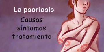 ¿Qué es la psoriasis? Causas, síntomas y tratamiento