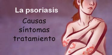 Lee más sobre el artículo ¿Qué es la psoriasis? Causas, síntomas y tratamiento