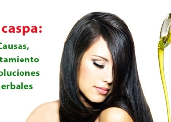 La caspa: Causas, tratamiento y soluciones herbales