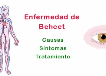 ¿Qué es la enfermedad de Behcet y por qué ocurre? Síntomas y tratamiento