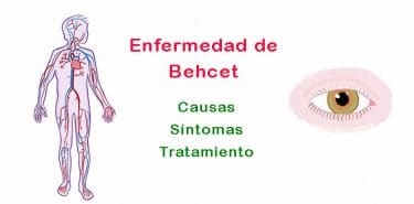 Lee más sobre el artículo ¿Qué es la enfermedad de Behcet y por qué ocurre? Síntomas y tratamiento