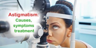 Read more about the article What is Astigmatism? Causes, symptoms and treatment