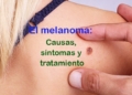 ¿Qué es el cáncer de piel tipo melanoma? Causas, síntomas y tratamiento
