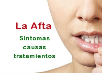 ¿Qué es la Afta? ¿Por qué sale? Síntomas, causas y tratamientos