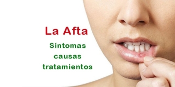 ¿Qué es la Afta? ¿Por qué sale? Síntomas, causas y tratamientos