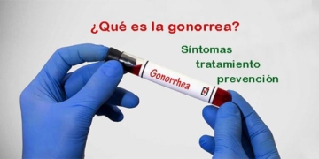 What is gonorrhea? Symptoms, treatment and prevention