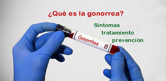 En este momento estás viendo ¿Qué es la gonorrea? Síntomas, tratamiento y prevención