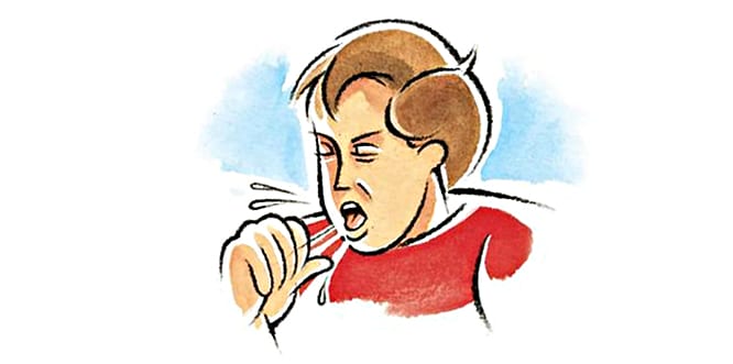 Вы сейчас просматриваете Что вызывает кашель? Лечение кашля