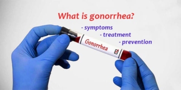What is gonorrhea? Symptoms, treatment and prevention