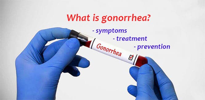 gonorrhea symptoms pictures