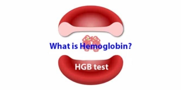 What is hemoglobin? Causes of high and low levels. HGB test