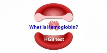 Read more about the article What is hemoglobin? Causes of high and low levels. HGB test