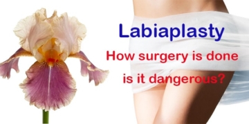 What is labiaplasty? How the surgery is done, is it dangerous?