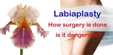 Read more about the article What is labiaplasty? How the surgery is done, is it dangerous?