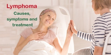 What is Lymphoma (Lymph Ca.)? Causes, symptoms and treatment
