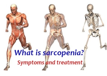 What is muscle loss (sarcopenia)? Symptoms and treatment