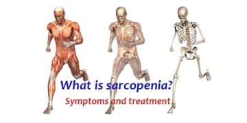 What is muscle loss (sarcopenia)? Symptoms and treatment