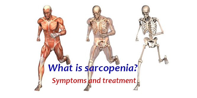 You are currently viewing What is muscle loss (sarcopenia)? Symptoms and treatment