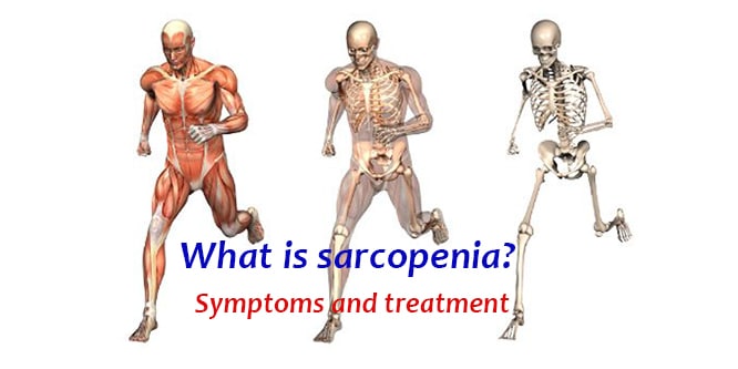 Read more about the article What is muscle loss (sarcopenia)? Symptoms and treatment