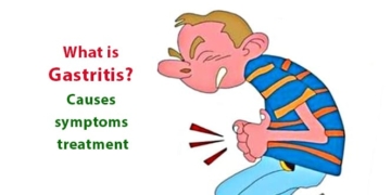 What is Gastritis? Causes, symptoms, treatment and natural healing