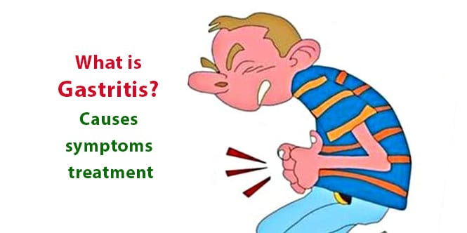 You are currently viewing What is Gastritis? Causes, symptoms, treatment and natural healing