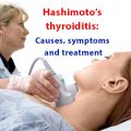 What is Hashimoto’s thyroiditis? Causes, symptoms and treatment