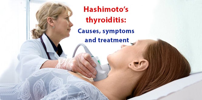 Read more about the article What is Hashimoto’s thyroiditis? Causes, symptoms and treatment