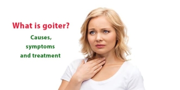 What is goiter? Causes, symptoms and treatment methods