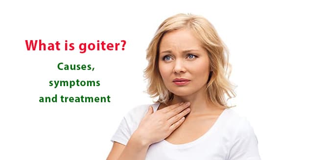 You are currently viewing What is goiter? Causes, symptoms and treatment methods
