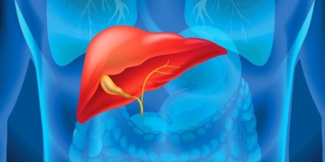 What is Cirrhosis? Causes, symptoms and treatments