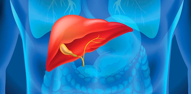 You are currently viewing What is Cirrhosis? Causes, symptoms and treatments