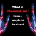 What is rheumatism? Causes, symptoms and treatment