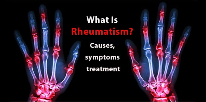 You are currently viewing What is rheumatism? Causes, symptoms and treatment