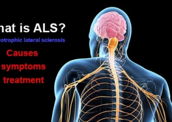 What is ALS? Causes, symptoms, treatment and recommendations