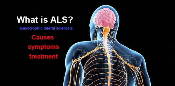 You are currently viewing What is ALS? Causes, symptoms, treatment and recommendations
