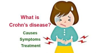 Read more about the article What is Crohn’s disease? Causes, symptoms and treatment