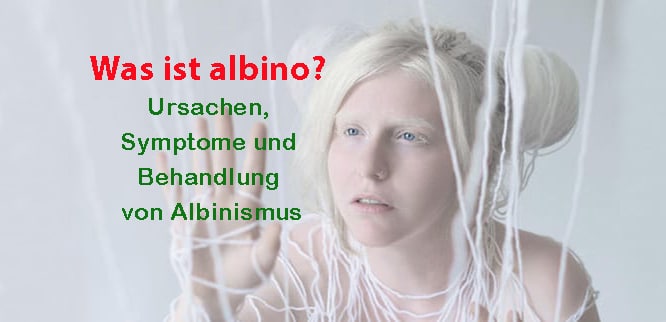 Was Ist Albino Ursachen Symptome Und Behandlung Von Albinismus