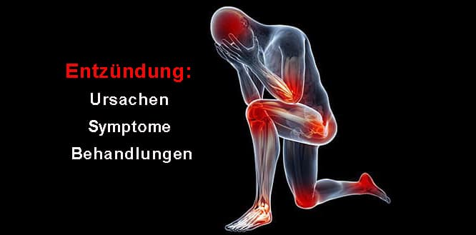 Entzündung: Ursachen, Symptome und Behandlungen