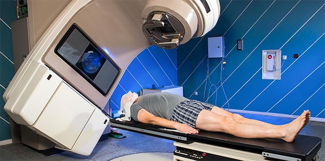 You are currently viewing Radiation therapy for cancer: Process and side effects of radiotherapy