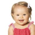 What is Down Syndrome? Causes, symptoms, diagnosis and treatments