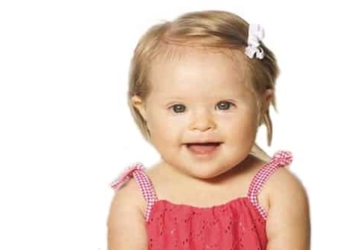 What is Down Syndrome? Causes, symptoms, diagnosis and treatments