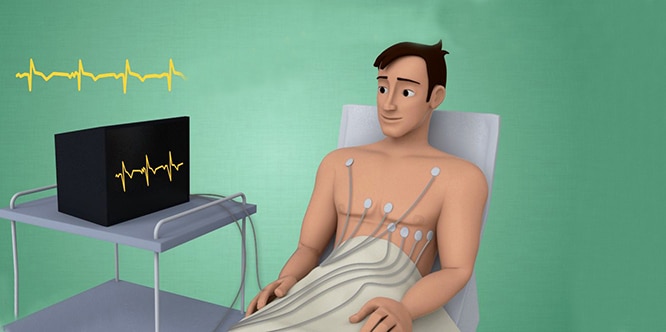 You are currently viewing Electrocardiogram (EKG & ECG): Procedure, risks and results