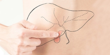 Erkrankungen der Gallenblase: Ursachen, Symptome und Behandlung